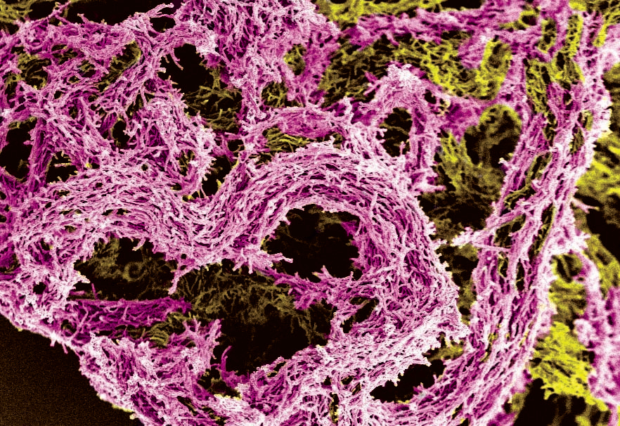 ‘Yes, it's true (yes, it's true),
I’m so happy to be stuck tubercule’