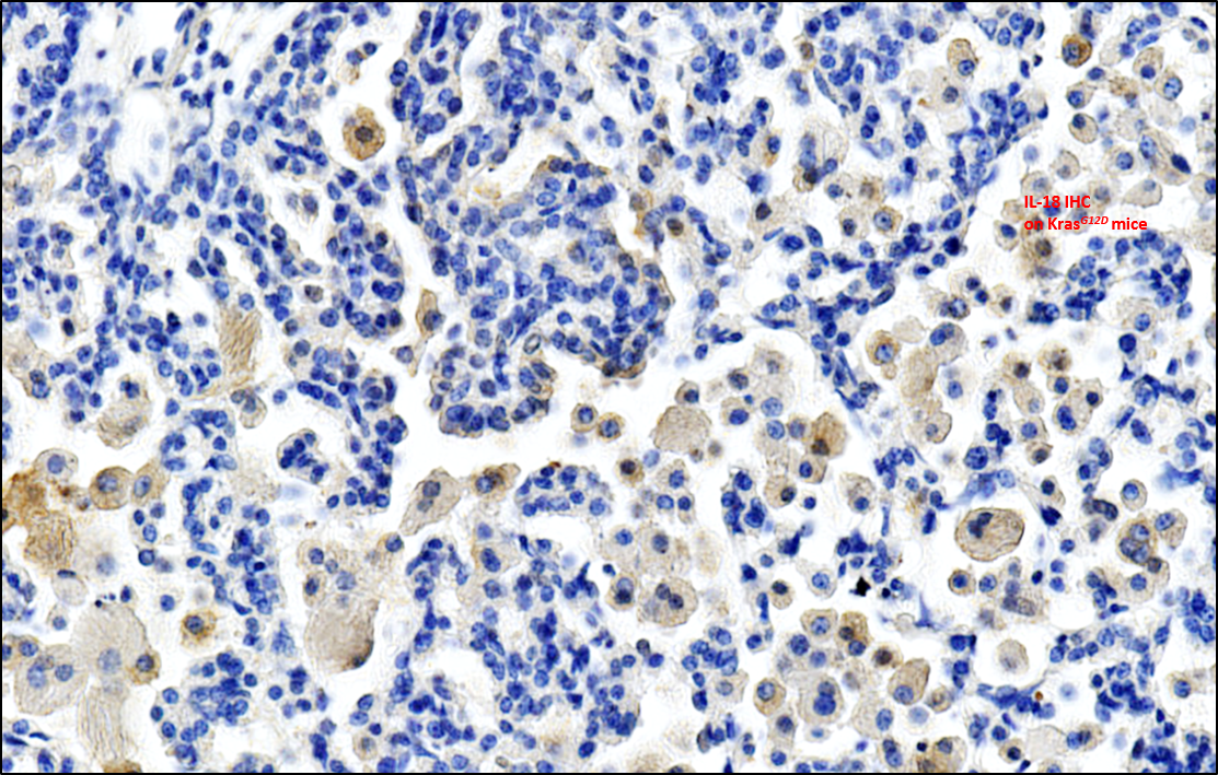 Activation of P2RX7 boosts antitumor immune responses and sensitizes tumors to immunotherapy