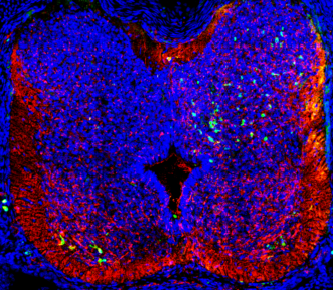 Zika virus: the African threat