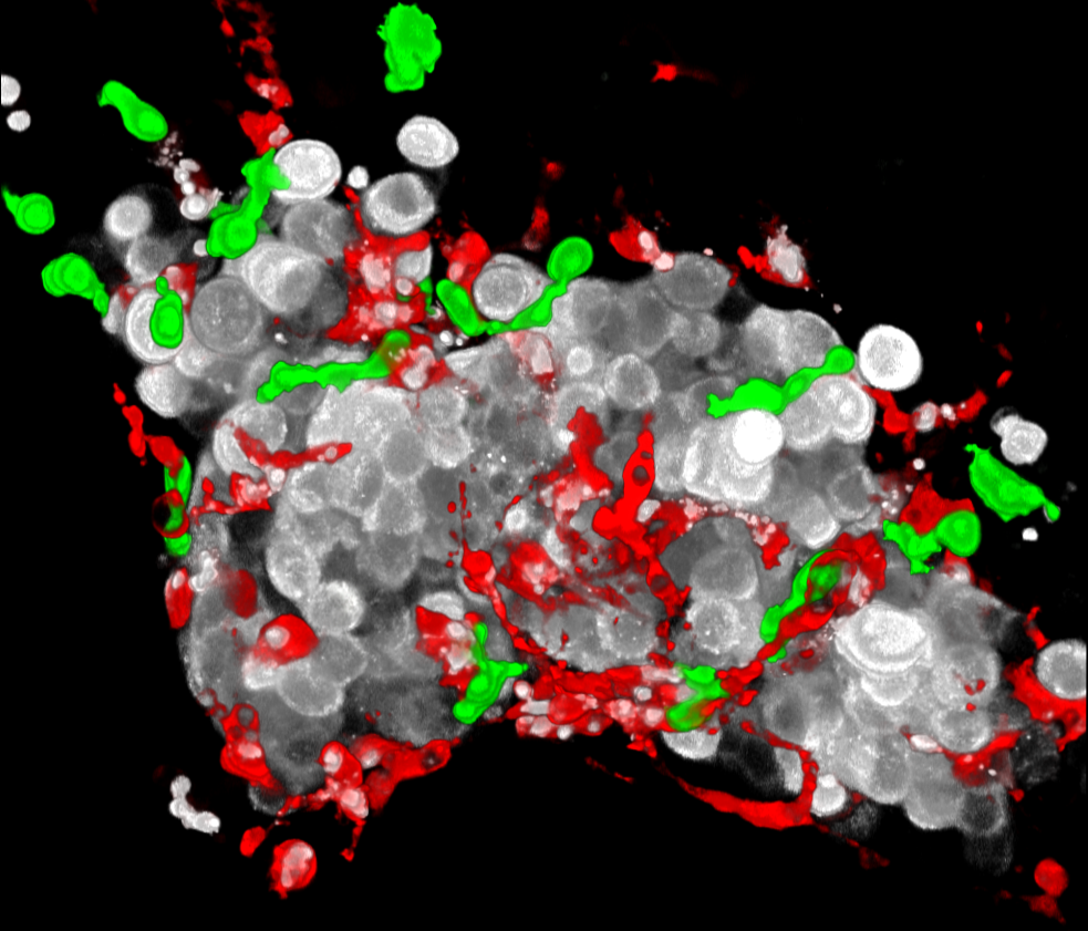 Innate immune evasion revealed in a colorectal zebrafish xenograft model