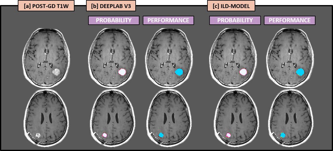 Improving the Generalizability of Deep Learning Segmentation of Brain Metastases on MRI
