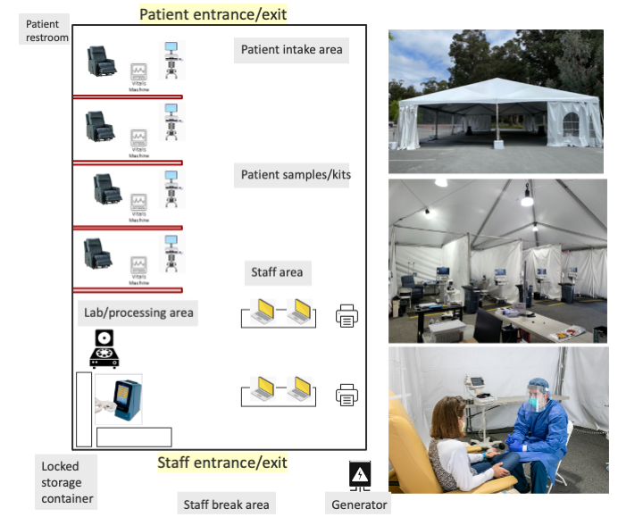Peginterferon Lambda for treatment of COVID-19 outpatients; a single-center, randomized controlled trial