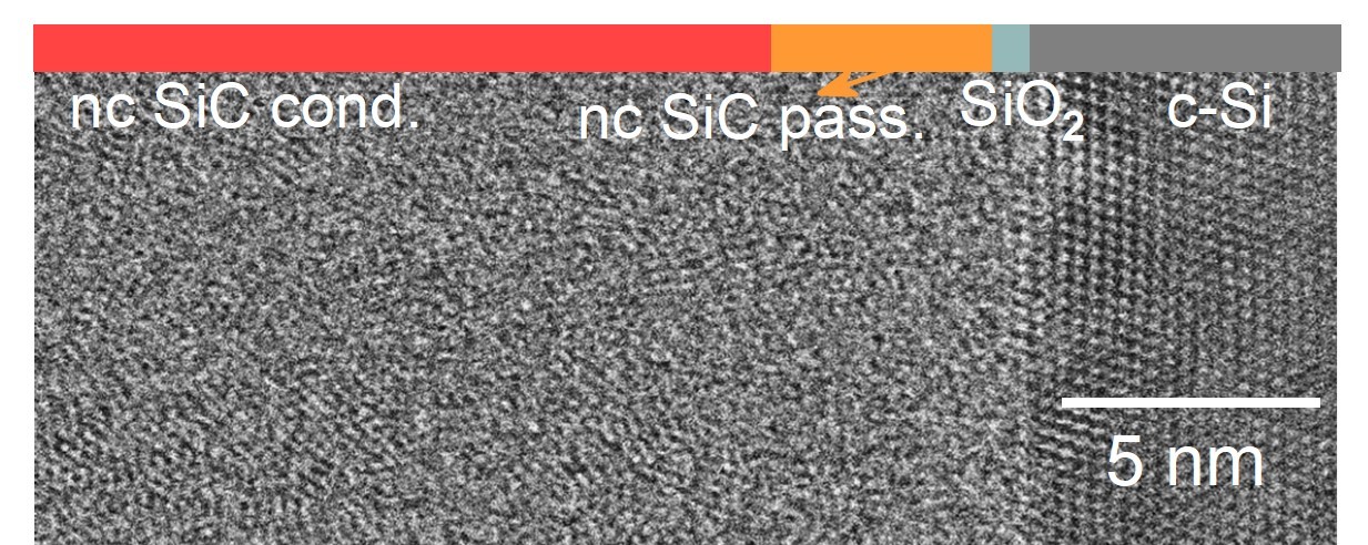 A SiC-based highly Transparent Passivating Contact for Crystalline Silicon Solar Cells approaching Efficiencies of 24%