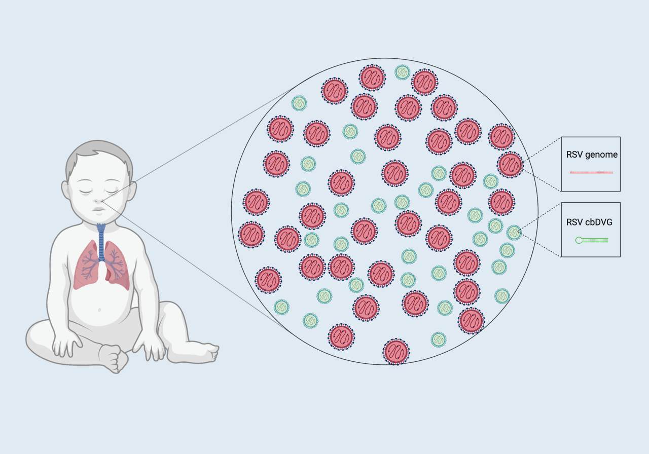 RSV clinical outcome: DVGs or no DVGs, that is the question