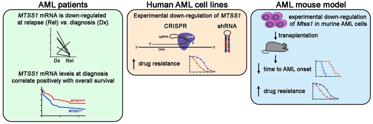 Downregulation of MTSS1 in acute myeloid leukemia is associated
with a poor prognosis, chemotherapy resistance, and disease aggressiveness