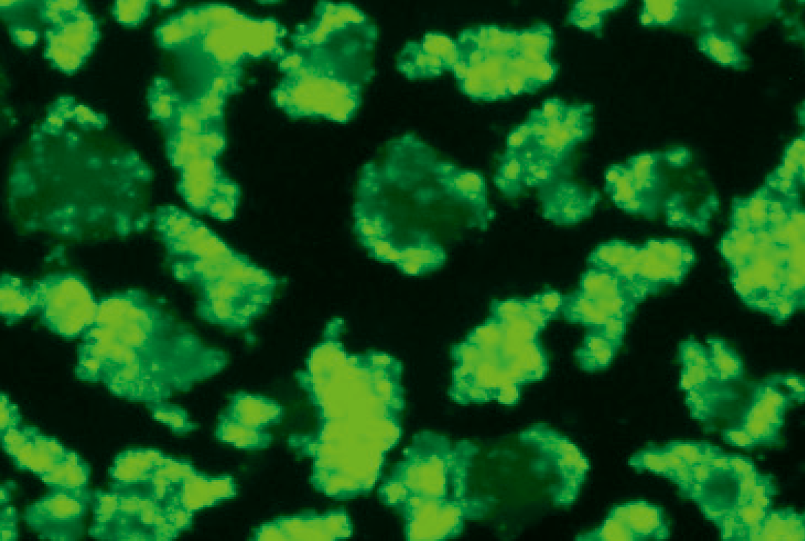CRISPR-based genome editing in primary human pancreatic islet cells