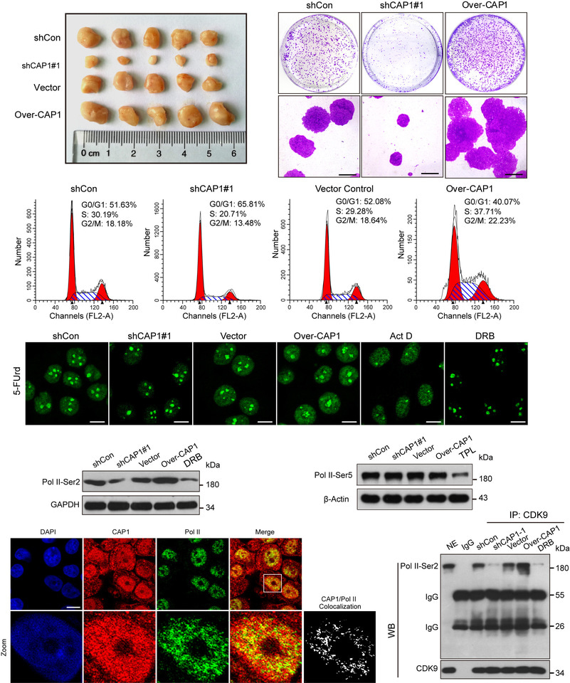 Novel role of CAP1 in regulation RNA polymerase II-mediated transcription elongation depends on its actin-depolymerization activity in nucleoplasm