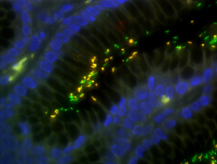 Population dynamics of clarithromycin-resistant Helicobacter pylori:
Searching for primary resistance