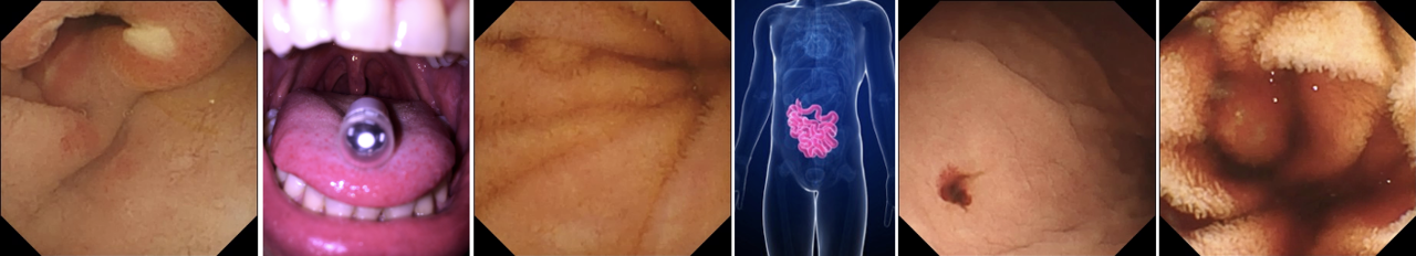 Kvasir-Capsule: A dataset for next-level capsule endoscopy AI methods