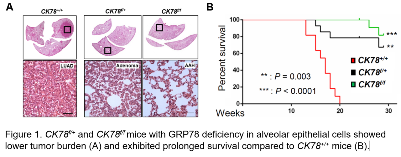 Endoplasmic reticulum chaperone GRP78/BiP is critical for mutant Kras-driven lung tumorigenesis 