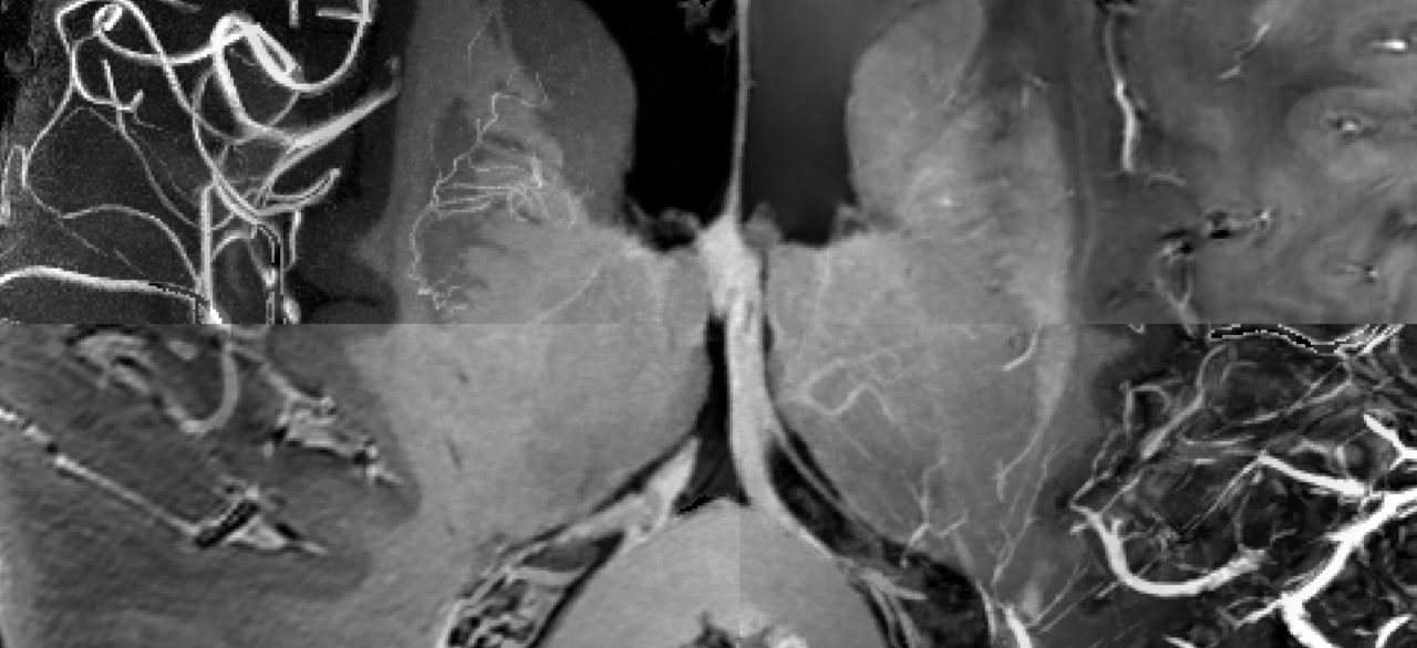 Ten years of unprecedented MRI data of a single participant released as a human phantom