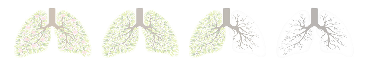 Chronic Obstructive Pulmonary Disease — smartphones could help improve patient outcomes