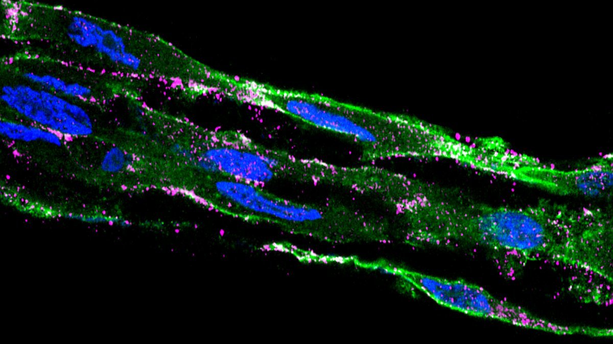 Deriving astrocytes from adult human gingiva to build an autologous implantable highway for neural precursor cell migration in the brain