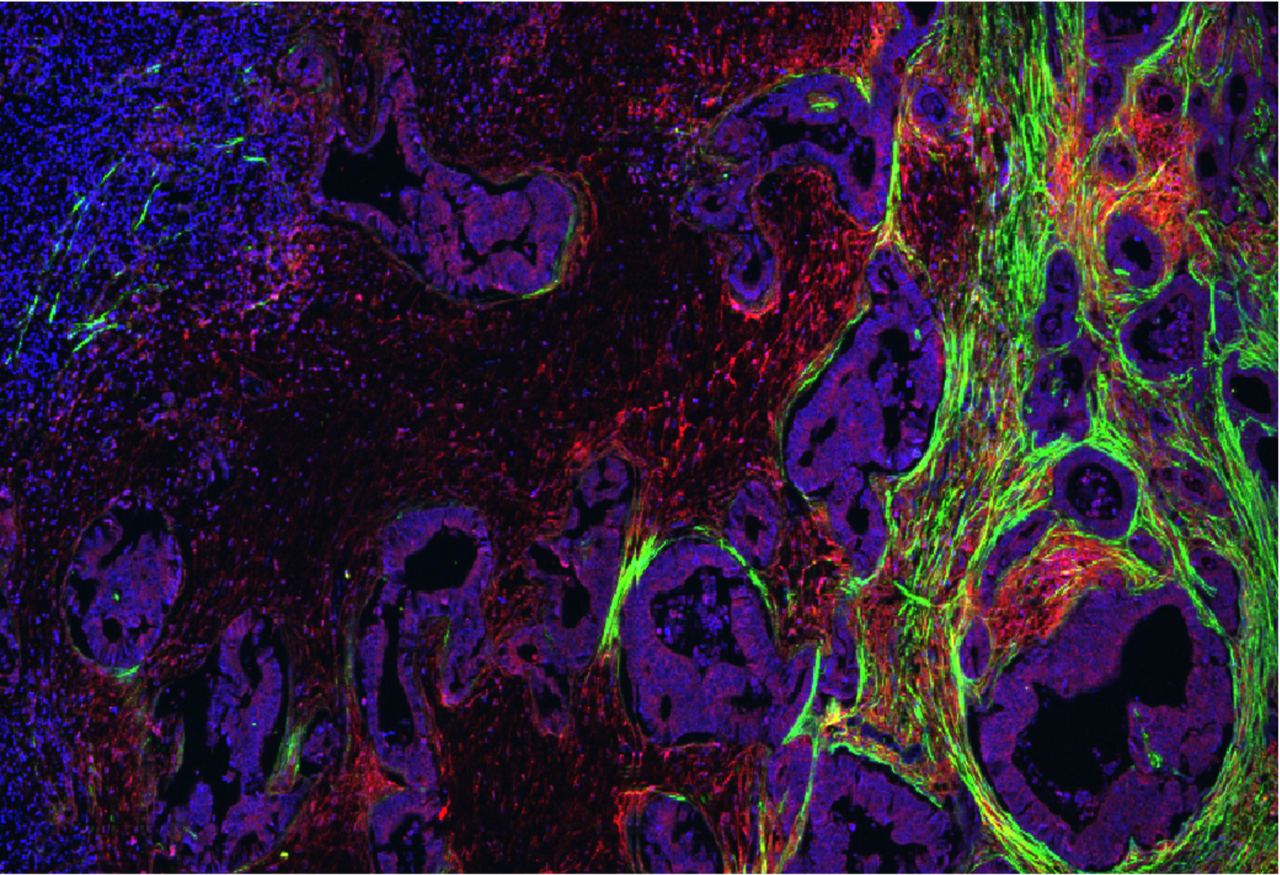 Solid-stressing out T cells