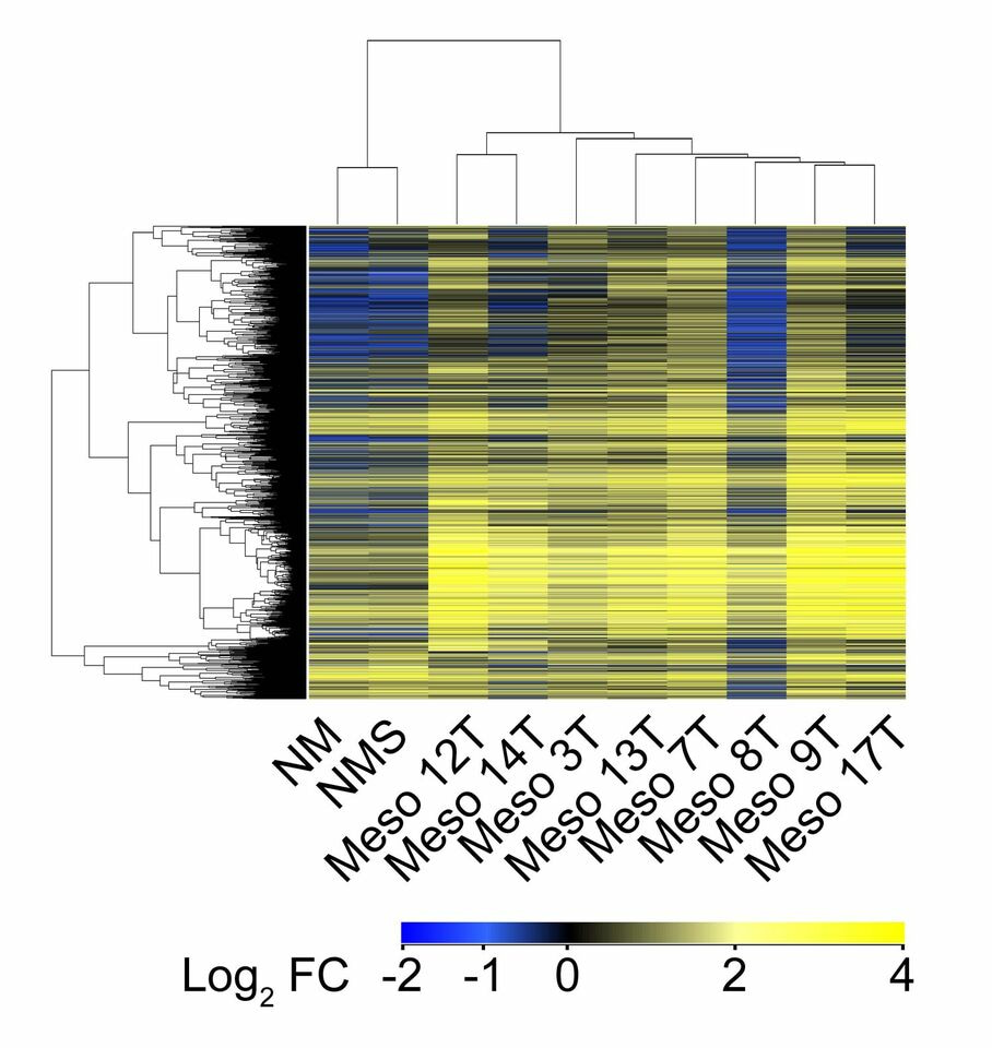 New insights into mesothelioma potential therapies 