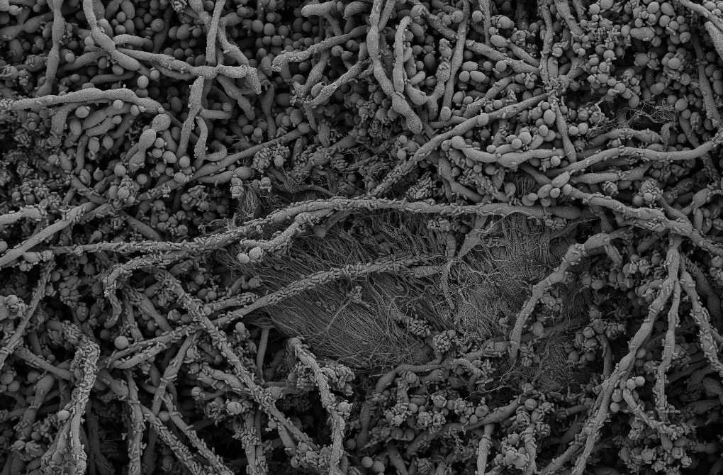 Fungal-bacterial biofilm assembly