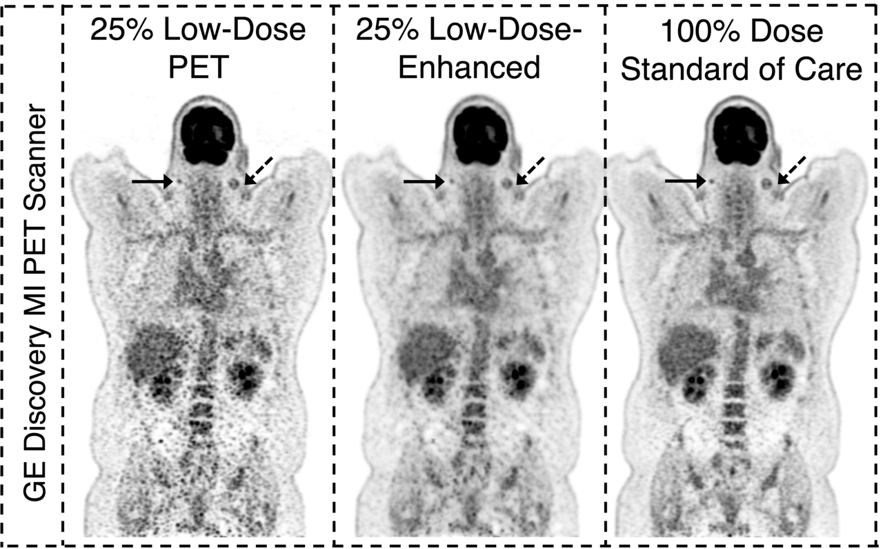 Deep Learning for Low-Dose PET Imaging