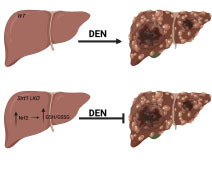 Sirt1 deficiency upregulates glutathione metabolism to prevent hepatocellular carcinoma initiation in mice