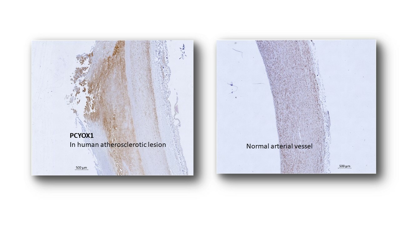 Prenylcysteine oxidase 1, an emerging player in atherosclerosis