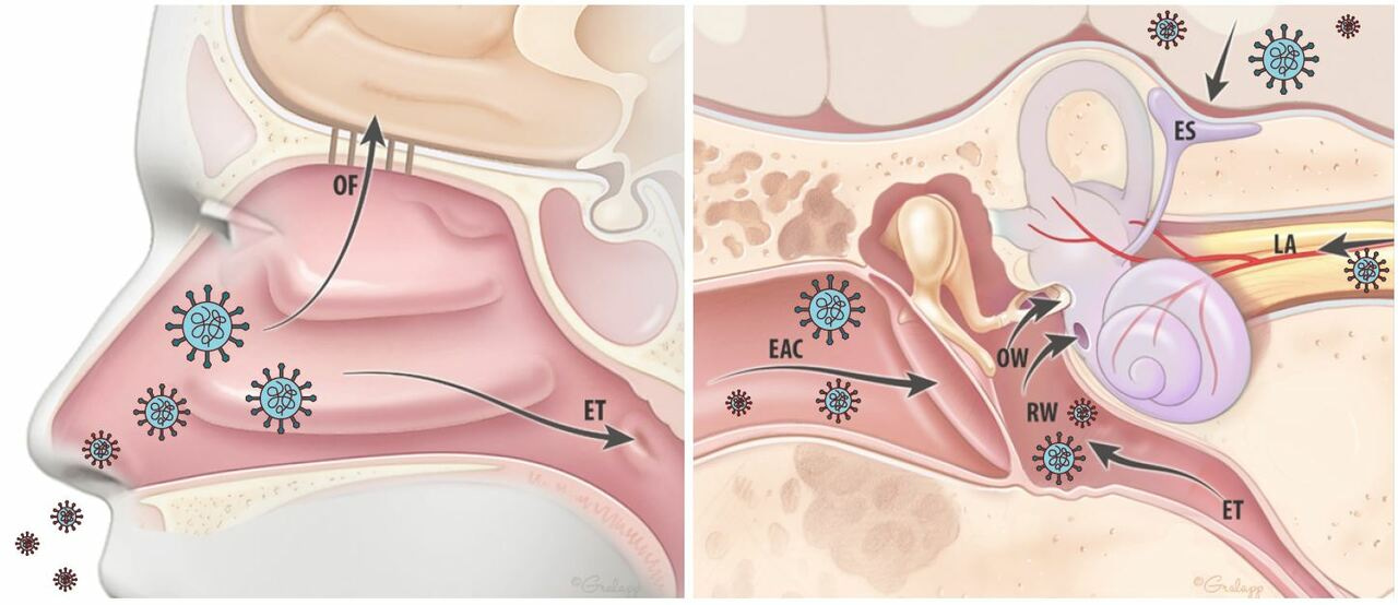 A link between COVID-19 and Symptoms of Hearing loss, Tinnitus, and Vertigo