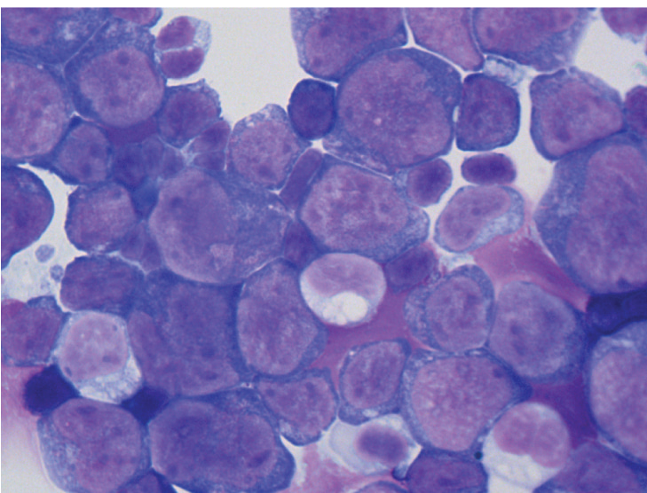 The tumor suppressor MIR139 is silenced by POLR2M to promote AML oncogenesis