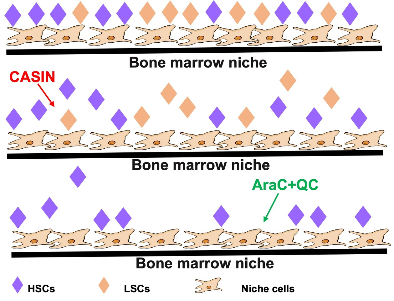 Quinacrine-CASIN combination overcomes chemoresistance in human acute lymphoid leukemia