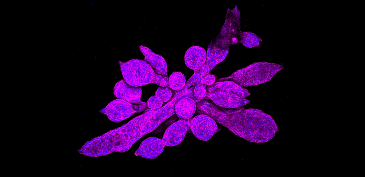 WHAT SHOULD I BECOME? COLLAGEN RECEPTOR DETERMINES CELL FATE 