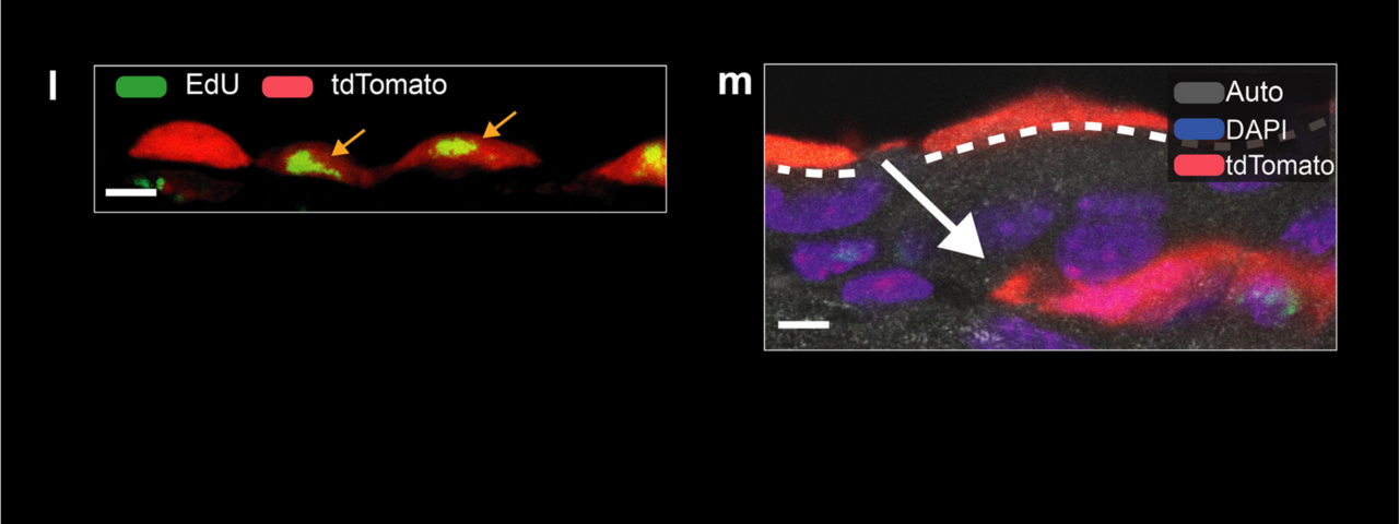 Intraperitoneal microbial contamination drives post-surgical peritoneal adhesions by mesothelial EGFR-signaling