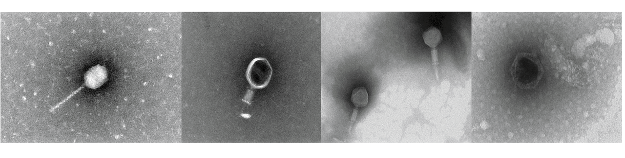 Friends or foes? Virus-encoded auxiliary metabolism and pesticide degradation genes might promote bacterial survival in pesticide-contaminated soils