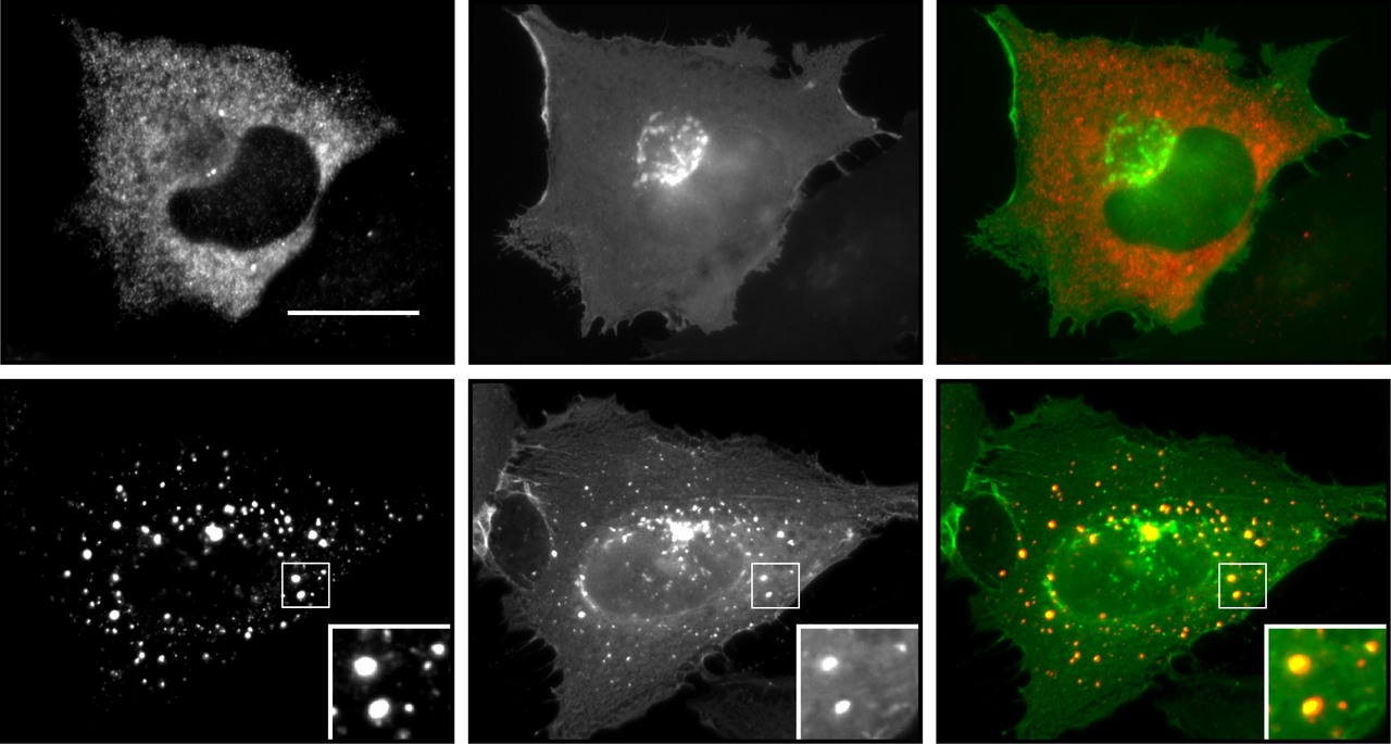 Gαi2-induced conductin/axin2 condensates inhibit Wnt/β-catenin signaling and suppress cancer growth