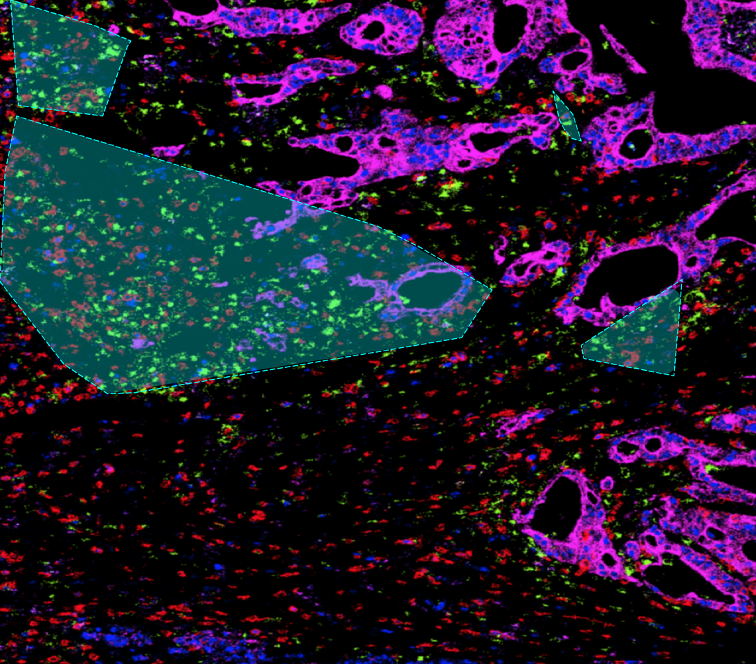 SIMPLI: Single-cell Identification from MultiPLexed Images