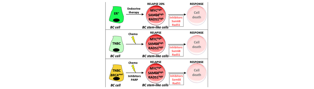 How to get breast cancer’s back to the wall