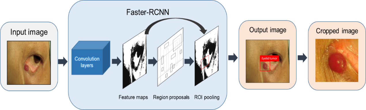 Artificial intelligence to detect malignant eyelid tumors from photographic images