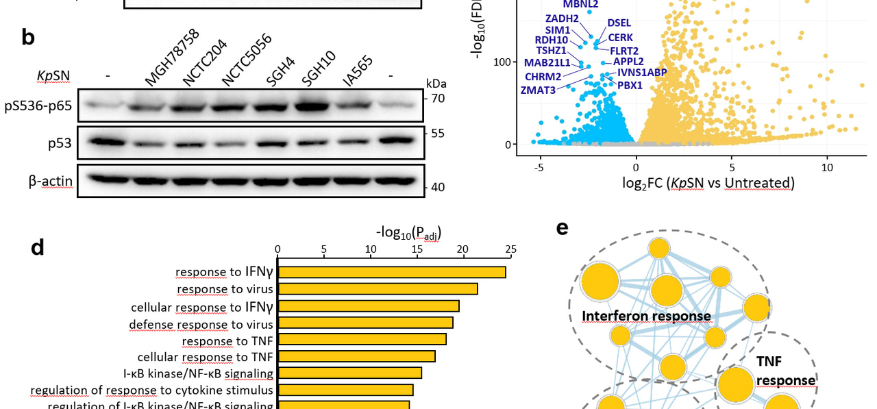 How bacterial regulation of p53 shapes tumorigenesis