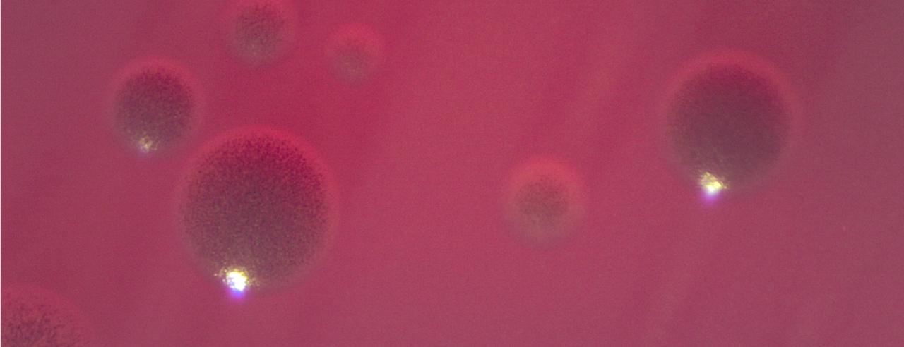 Vaginal Porphyromonas species carve their own path of destruction