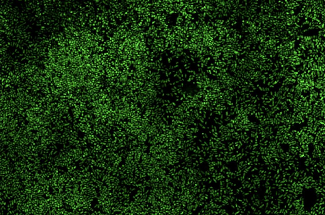 One protein, many functions: SslE, the E. coli mucin degrading enzyme that facilitates biofilm formation
