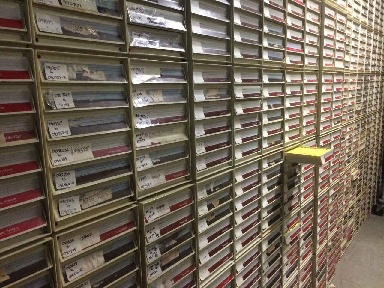 Unveiling the mystery of hidden Ebola virus  persistence