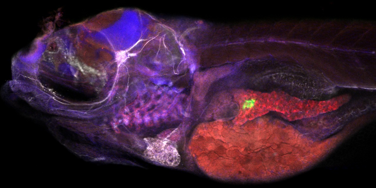 Multidimensional chromatin profiling of zebrafish pancreas to uncover and investigate disease-relevant enhancers