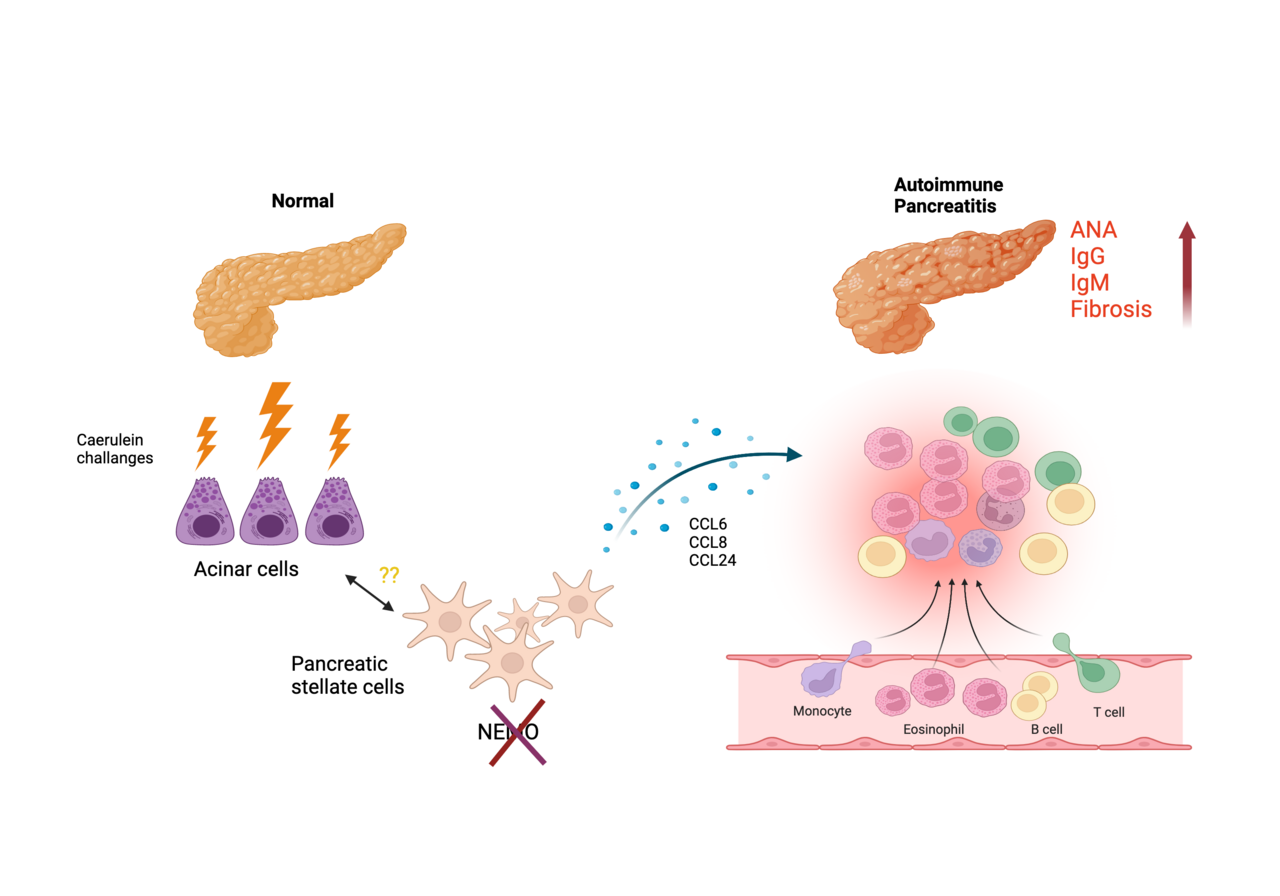 NF-kappa B in pancreatic stellate cells protects the pancreas against autoimmune inflammation