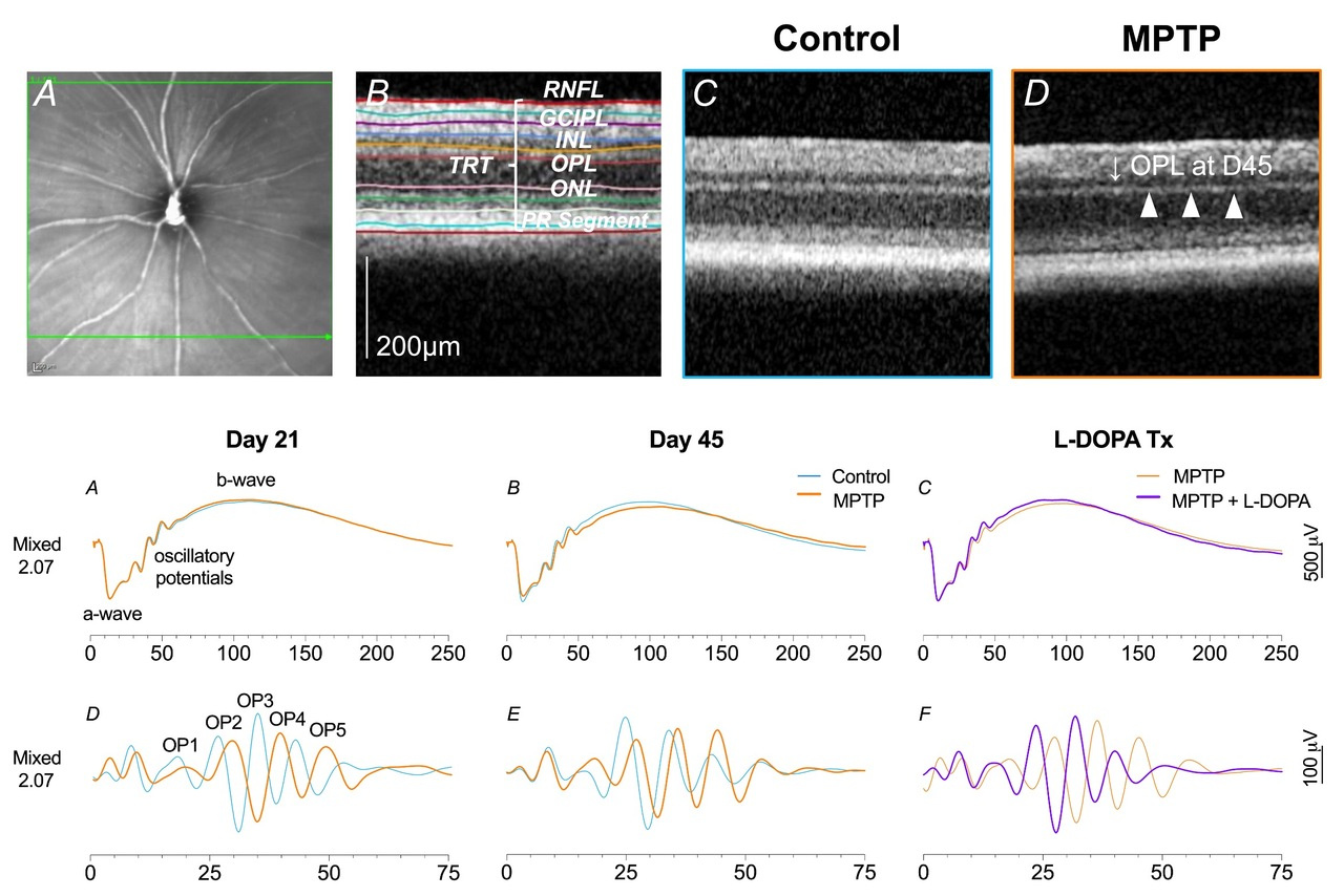 Characterization of Retinal Function & Structure in the MPTP Murine Model of Parkinson’s Disease 
