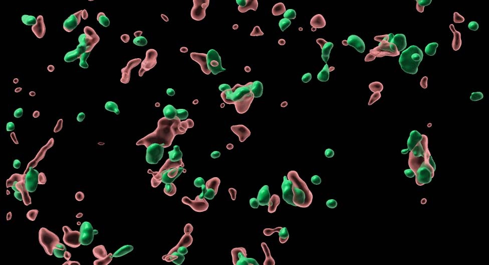 CTTNBP2, zinc and liquid-liquid phase separation, two dancers and one tango
