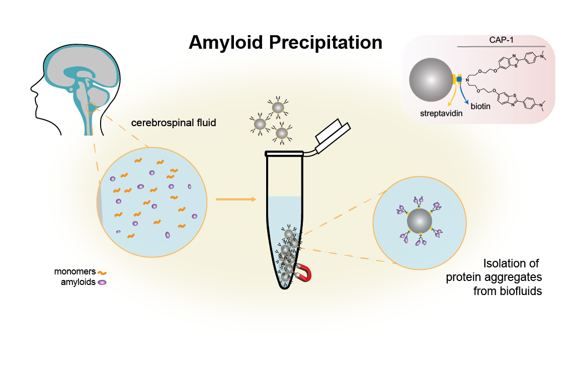 ‘Finding a needle in a haystack’ – new method to isolate toxic amyloids in biofluids
