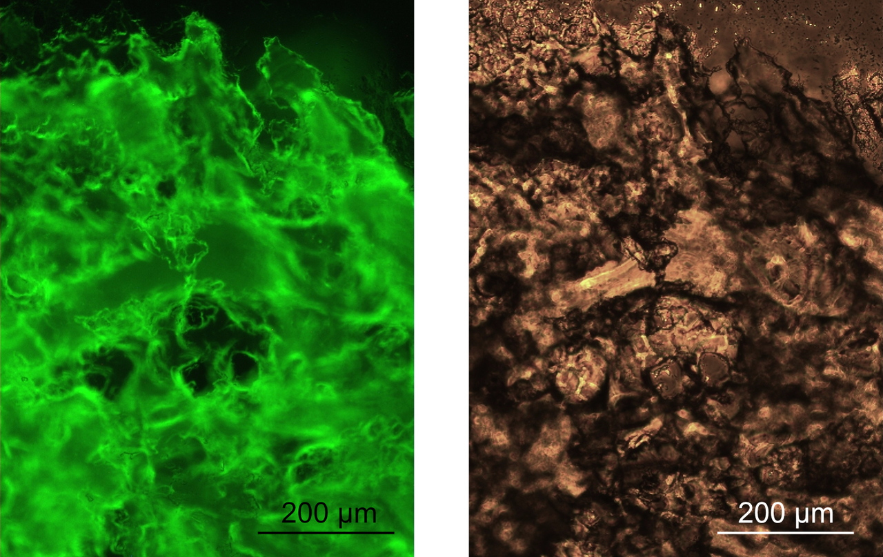 Spidroin N-terminal domain forms amyloid- like fibril based hydrogels and provides a protein immobilization platform