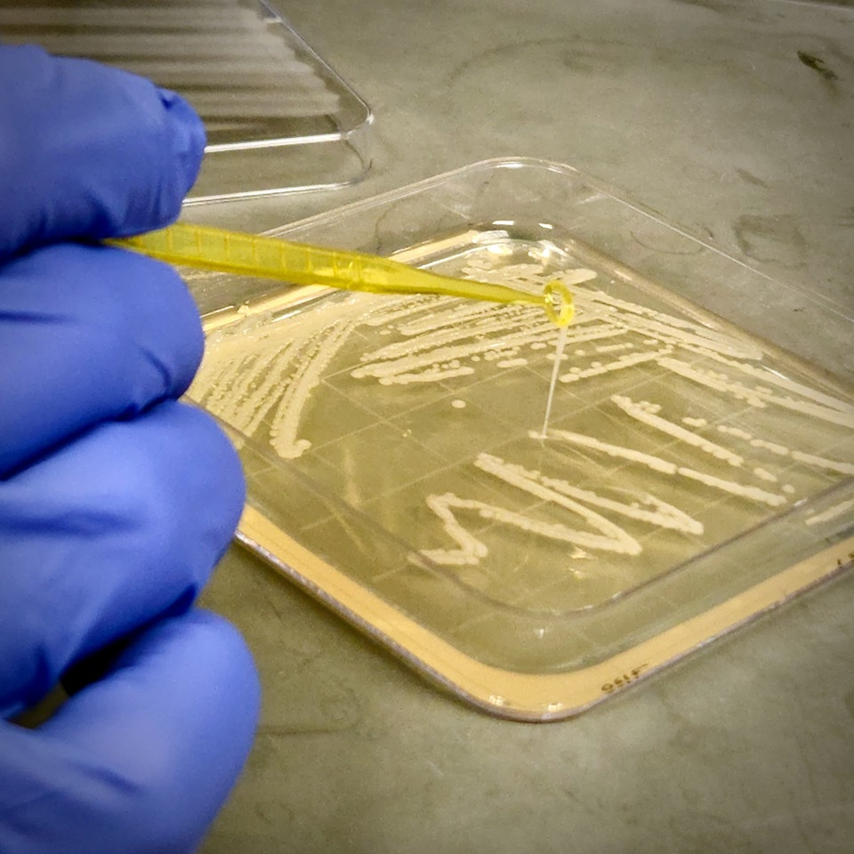 The whole nine yards: an integrated approach to understanding Klebsiella infection