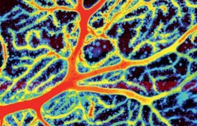 The FEBS Journal Special Issue on Neurodegeneration