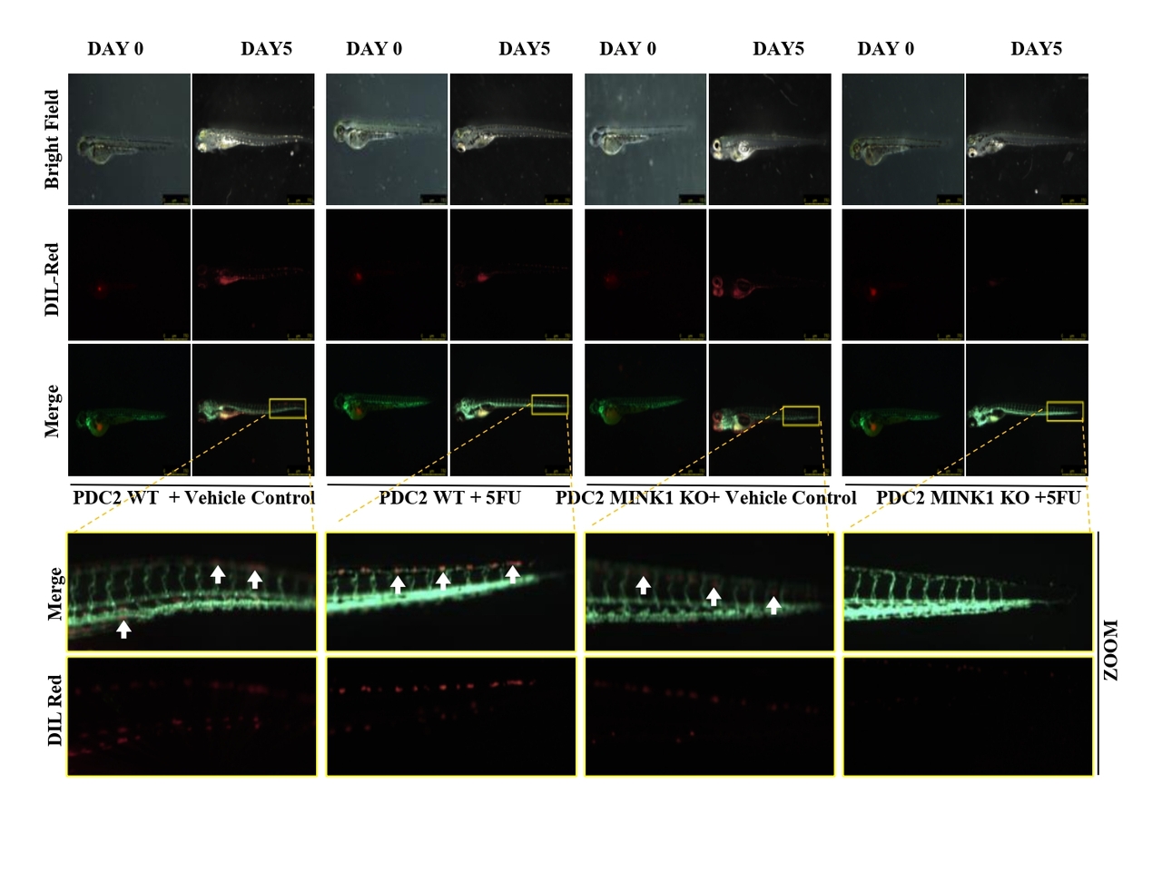 MINK1 drives 5FU resistance via AKT/MDM2/p53 axis : Reveals a high throughput kinome knockout screening in OSCC.