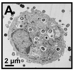 Group B Streptococcus turns defense into offense during pregnancy infections