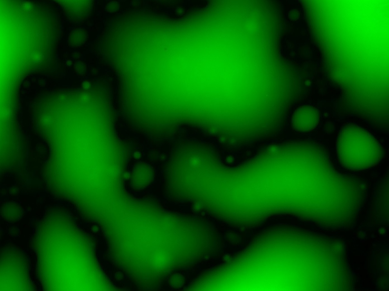 The amyloidogenic proteins hallmark to either Alzheimer’s or Parkinson’s disease aggregate together inside coacervates
