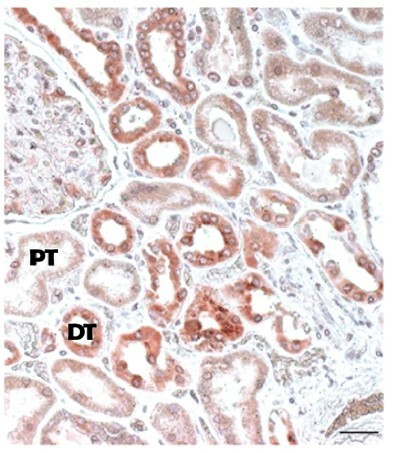 Finding the glucagon receptor using antibodies - not a good idea 