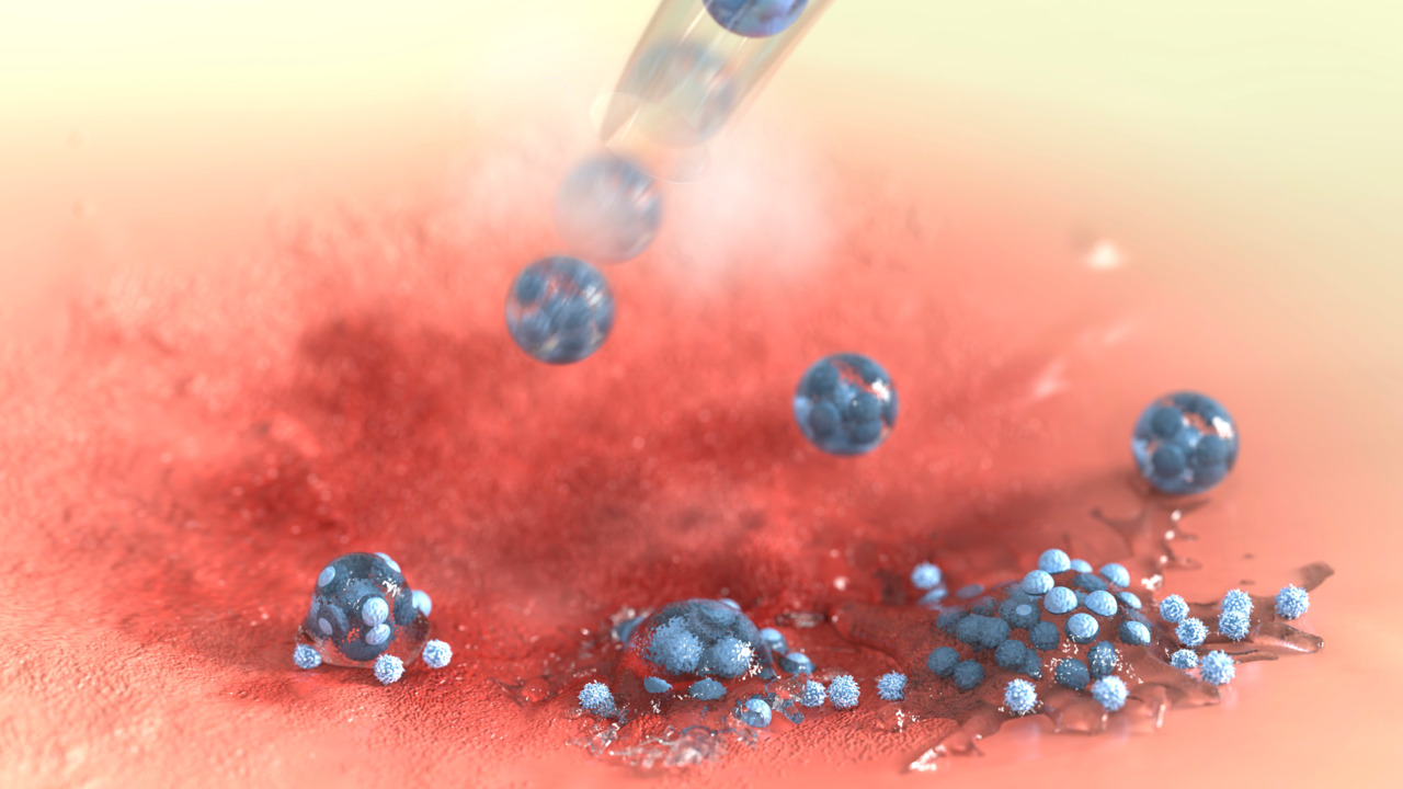 A bead-jet bioprinter specialized for stem cell therapy